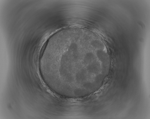 X0000111170241200907221034