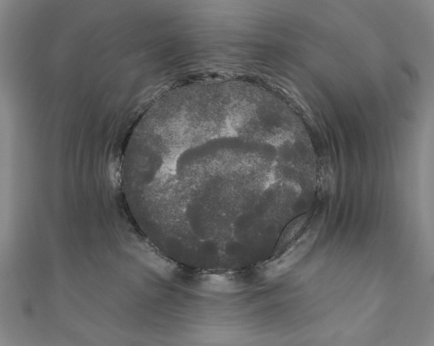 X0000111170285200907221034