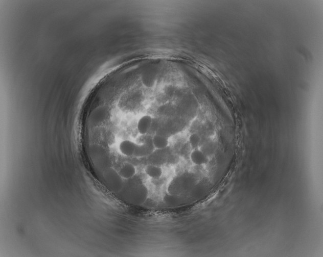 X0000111170343200907221032