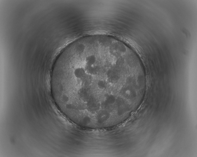 X0000111170345200907221033