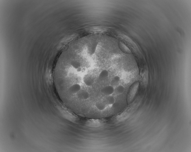 X0000111170381200907221033