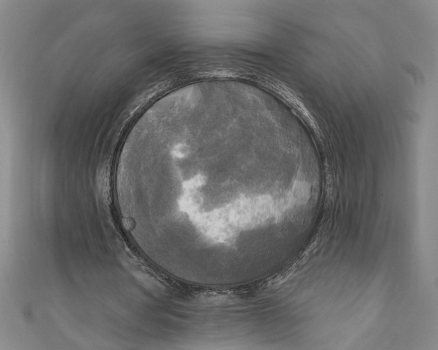 X0000111170386200907221032