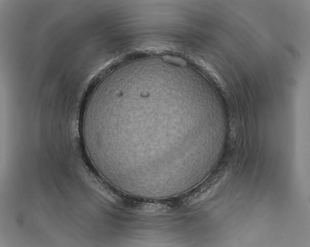 X0000111170399200907221032