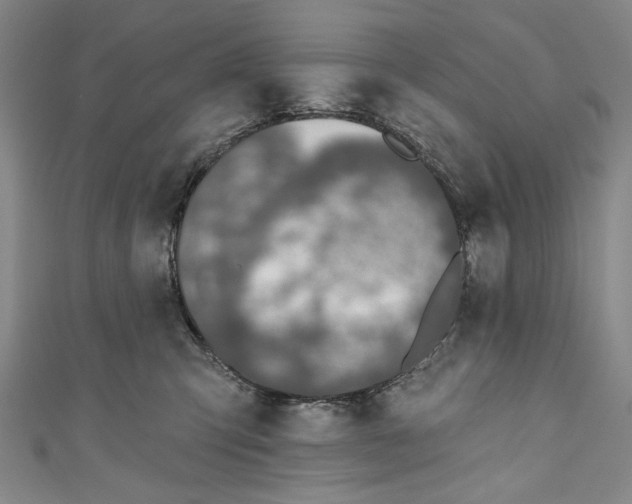 X0000111170423200907221032