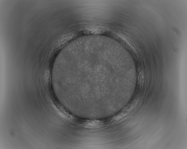 X0000111170459200907221032