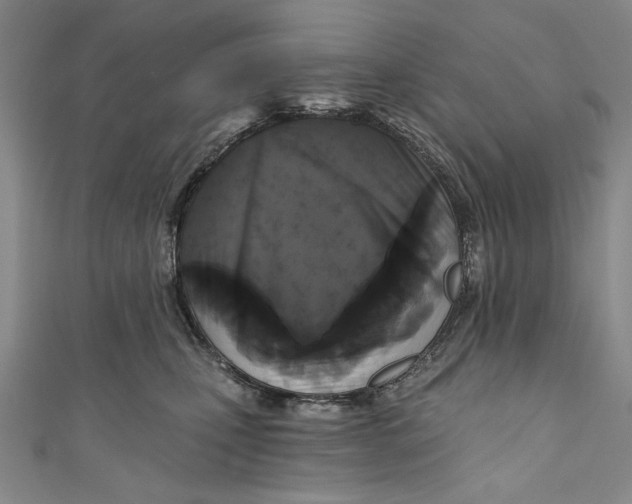 X0000111170471200907221032