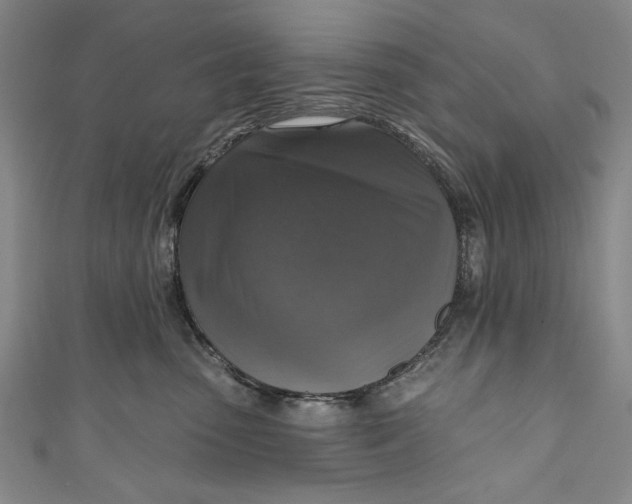 X0000111170475200907221032