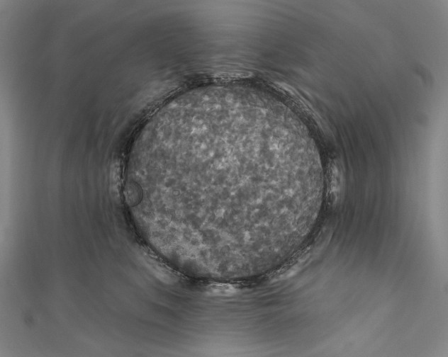 X0000111170519200907221031