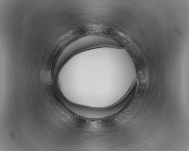 X0000111170564200907221030