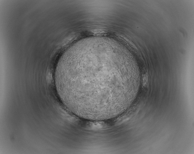 X0000111170618200907221029