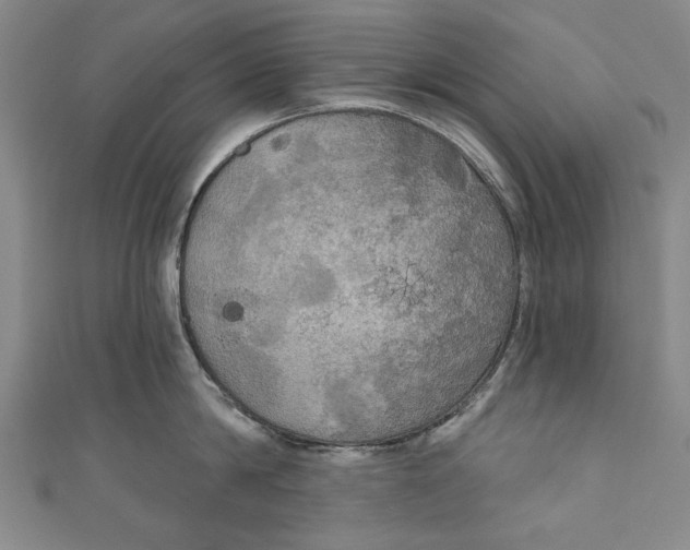 X0000111170814200907221027