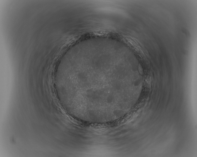 X0000111170817200907221026