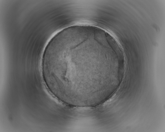 X0000111170864200907221027