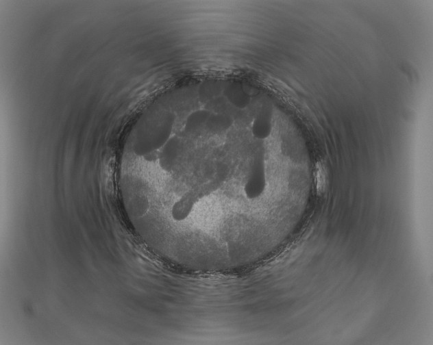 X0000111171059200907221023