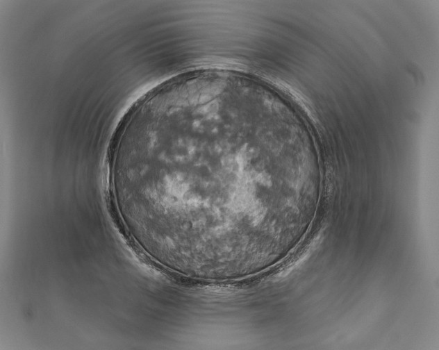 X0000111171125200907221022