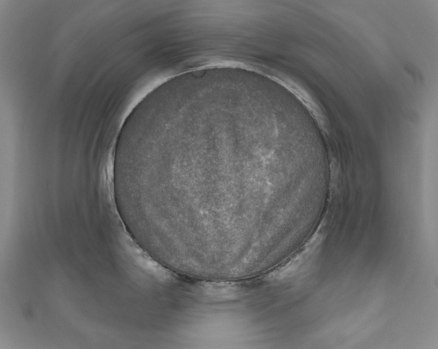 X0000111171198200907221021