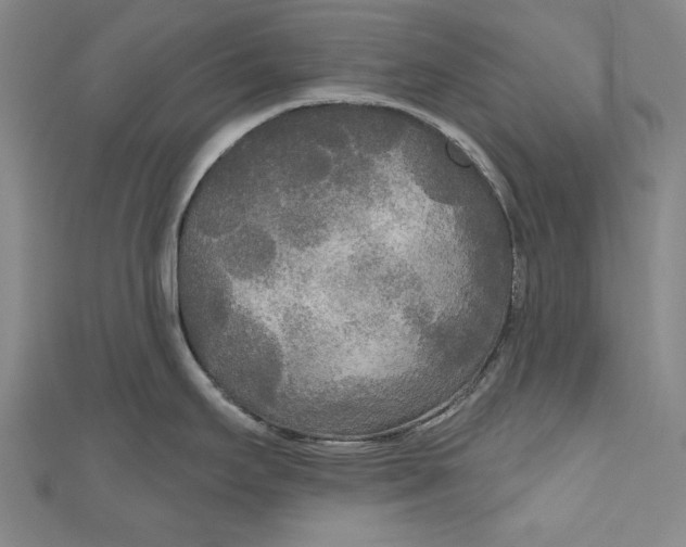 X0000111171295200907221020