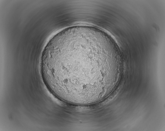 X0000111171379200907221019