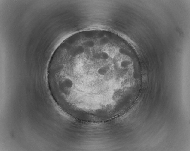 X0000111171423200907221018