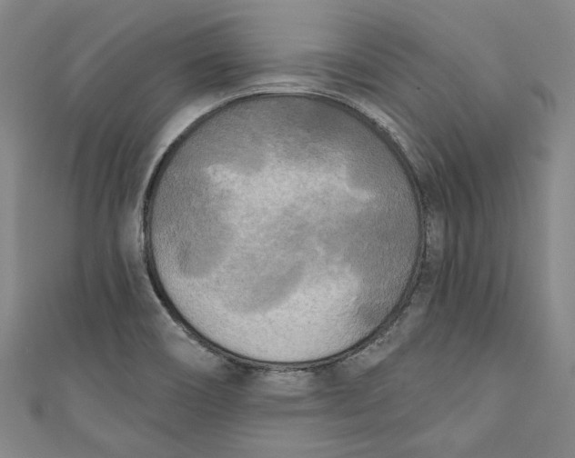 X0000111171466200907221018