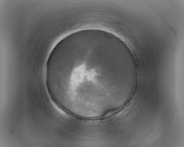 X0000111171519200907221017