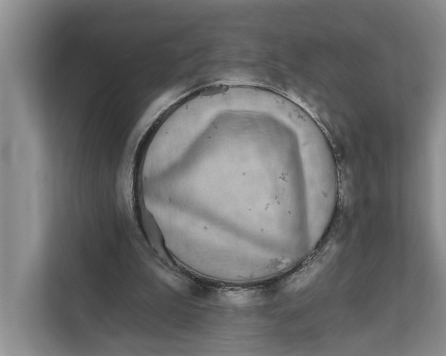 X0000111170199200907291130