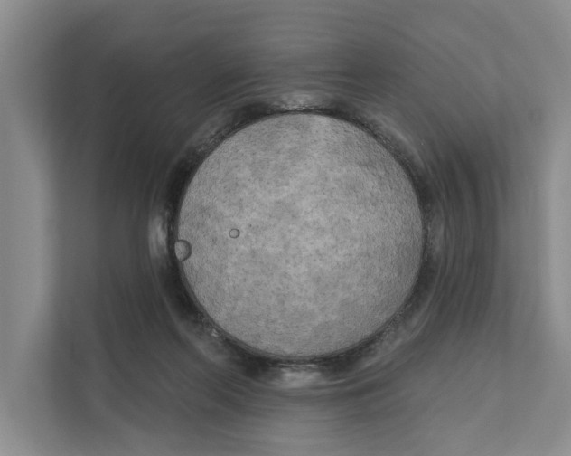 X0000111170214200907291130