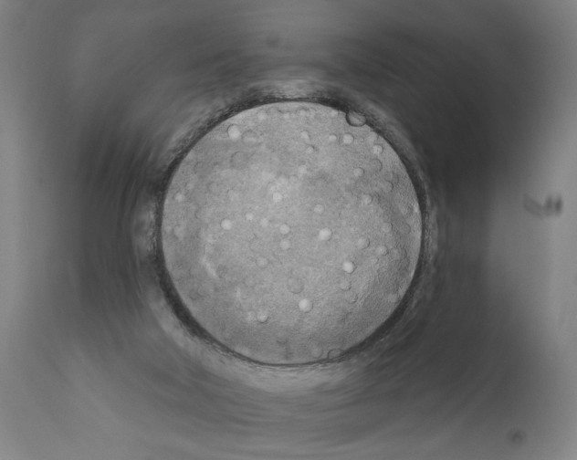 X0000111170018200908121058