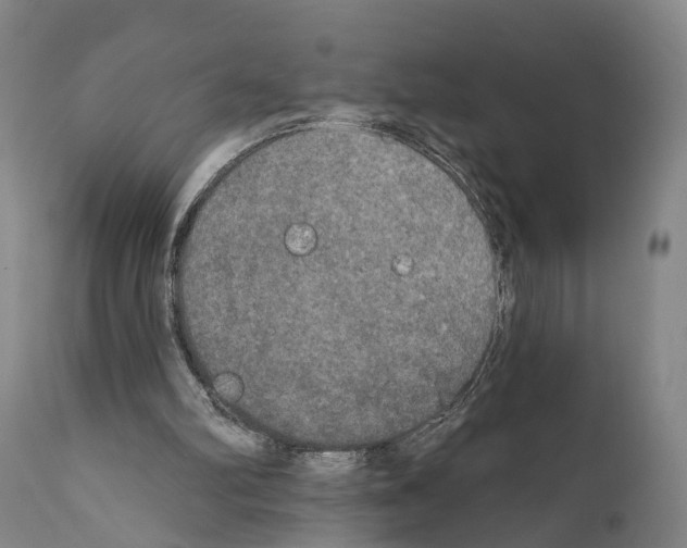 X0000111170102200908121056