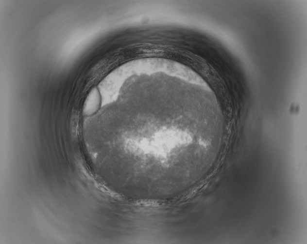 X0000111170194200908121055