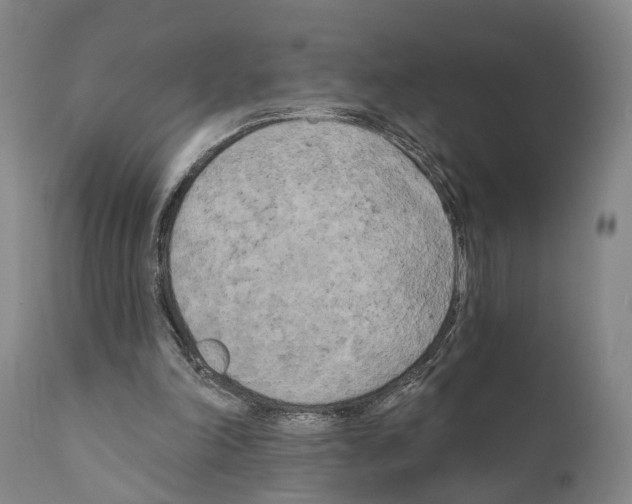 X0000111170198200908121055