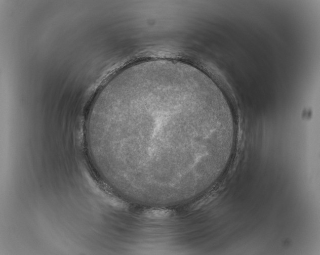 X0000111170202200908121055