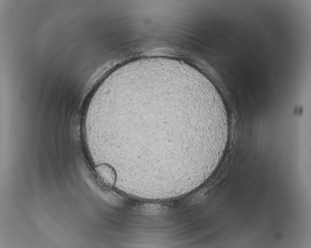 X0000111170298200908121053