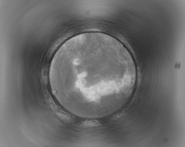 X0000111170386200908121051