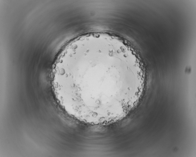 X0000111171314200908121038