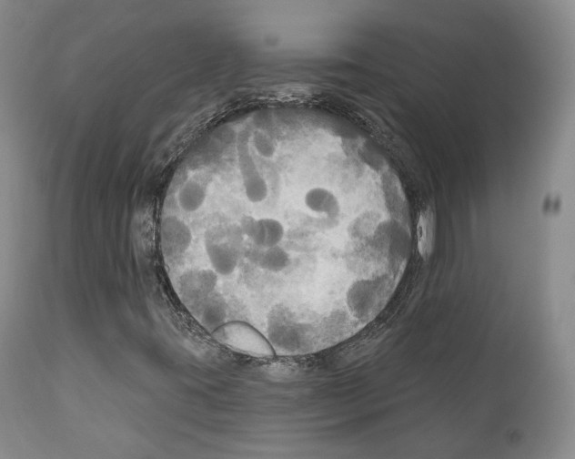 X0000111171395200908121036