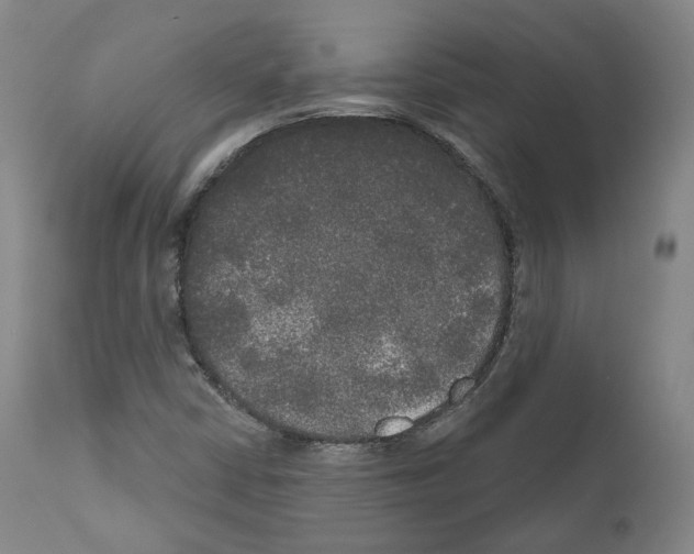 X0000111171402200908121036