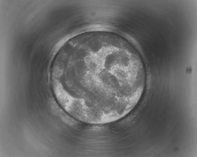 X0000111171419200908121036