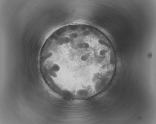 X0000111171423200908121036