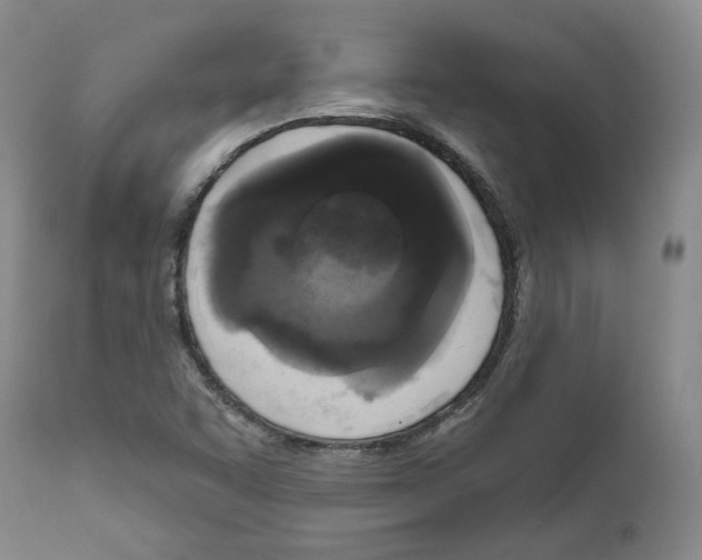 X0000111171455200908121035