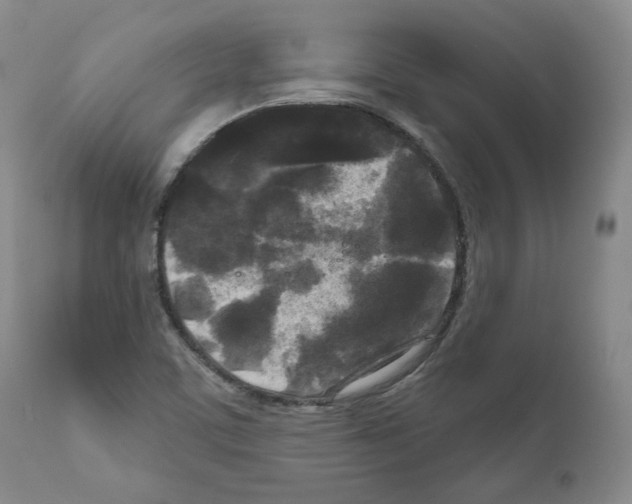 X0000111171459200908121035