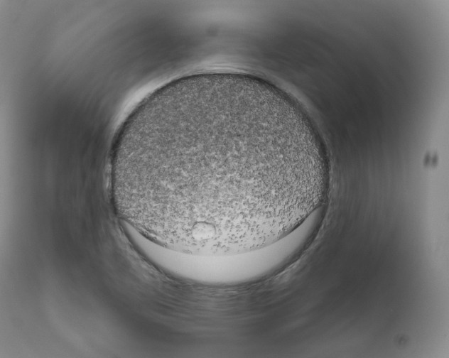 X0000111171461200908121035