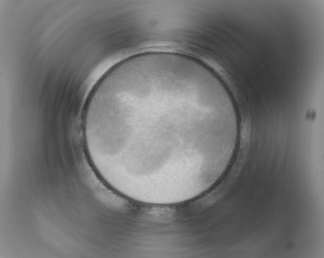 X0000111171466200908121035