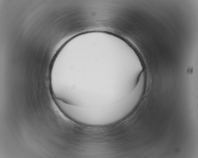 X0000111171468200908121035