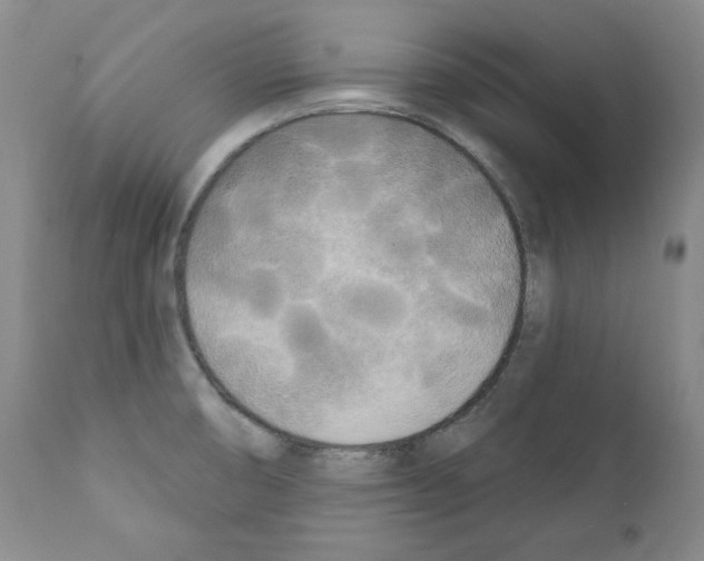 X0000111171474200908121035