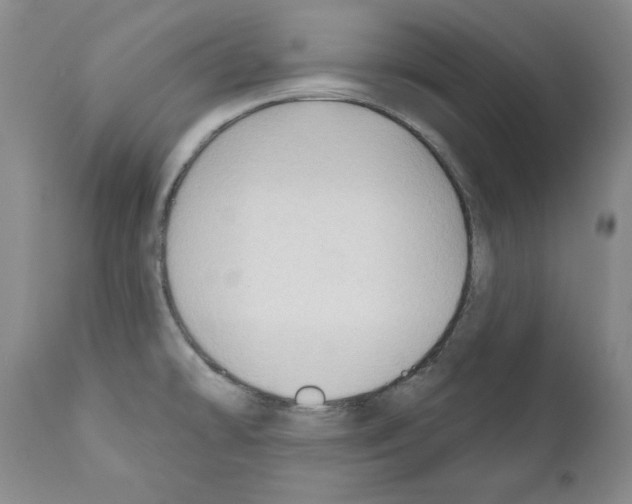 X0000111171478200908121035