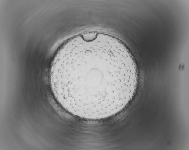 X0000111171499200908121034