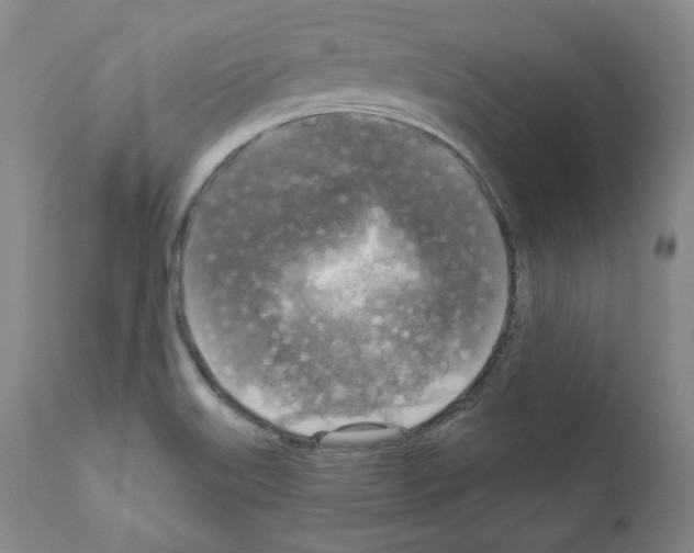 X0000111171515200908121035