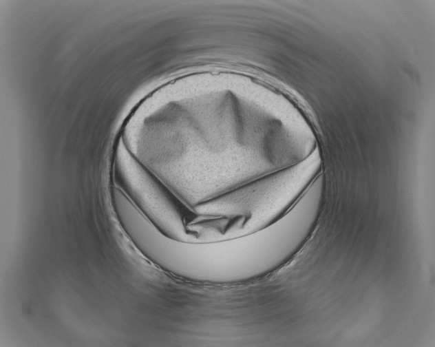 X0000111181530200907221038