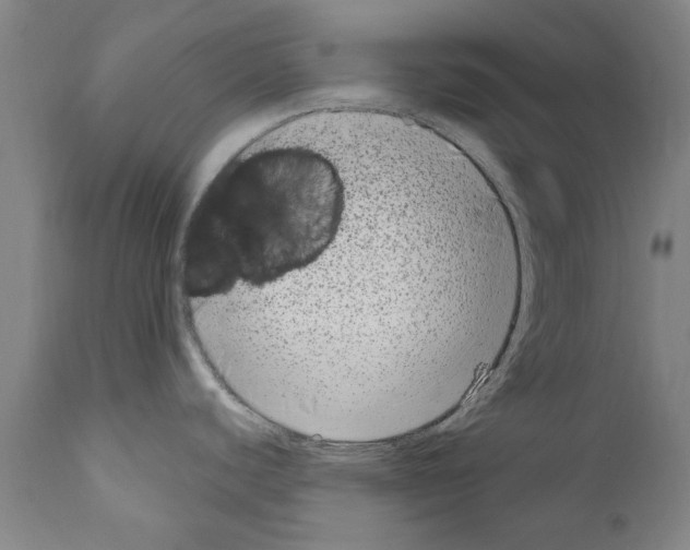 X0000111181440200908121100